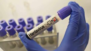 OMS garante que o risco de propagação de hantavírus é “absolutamente baixo”