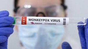Angola reactiva Plano de Contingência face à nova vaga de Mpox. Já são mais de 500 casos